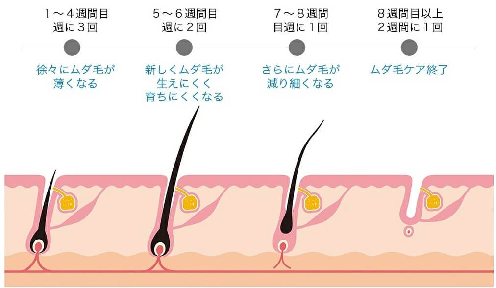 脱毛の目安